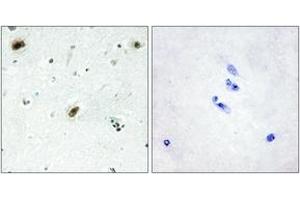 Immunohistochemistry analysis of paraffin-embedded human brain tissue, using ABL1 Antibody.