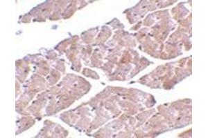 Immunohistochemistry of TRPC3 in mouse heart tissue with this product at 2 μg/ml.