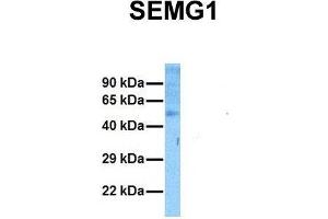 Host:  Rabbit  Target Name:  SEMG1  Sample Tissue:  Human Ovary Tumor  Antibody Dilution:  1. (SEMG1 antibody  (N-Term))