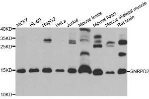 Western blot analysis of extracts of various cell lines, using SNRPD2 antibody. (SNRPD2 antibody)