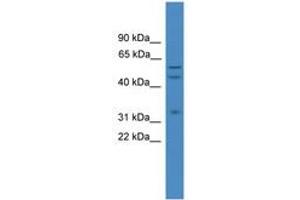 Image no. 1 for anti-ELK1, Member of ETS Oncogene Family (ELK1) (AA 301-350) antibody (ABIN6745314) (ELK1 antibody  (AA 301-350))