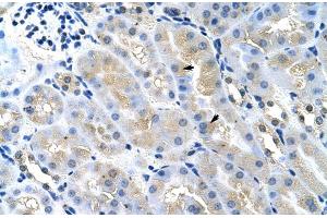 Rabbit Anti-Tsg101 Antibody ,Paraffin Embedded Tissue: Mouse Kidney  Cellular Data: Epithelial cells of renal tubule  Antibody Concentration: 4.