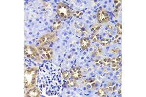 Immunohistochemistry of paraffin-embedded Rat kidney using GIP antibody at dilution of 1:100 (x400 lens). (GIP antibody)