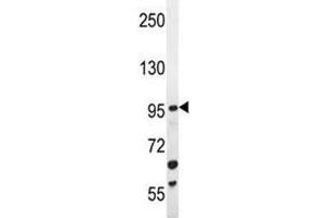 ZGRF1 antibody western blot analysis in mouse Neuro-2a lysate (ZGRF1 antibody  (AA 38-66))