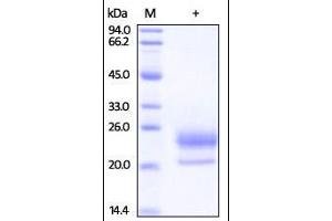 Human Niemann-Pick Type C2, His Tag on SDS-PAGE under reducing (R) condition.