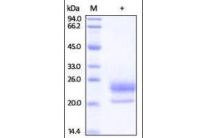 Human Niemann-Pick Type C2, His Tag on SDS-PAGE under reducing (R) condition. (NPC2 Protein (AA 20-151) (His tag))