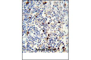 Lambda light chain Antibody (ABIN1539834 and ABIN2843347) immunohistochemistry analysis in formalin fixed and paraffin embedded human lymph tissue followed by peroxidase conjμgation of the secondary antibody and DAB staining. (Lambda-IgLC antibody)
