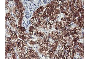 Immunohistochemical staining of paraffin-embedded Human liver tissue using anti-CYP2A6 mouse monoclonal antibody.
