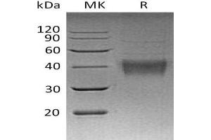 Western Blotting (WB) image for Tumor Necrosis Factor (Ligand) Superfamily, Member 9 (TNFSF9) (Active) protein (His tag) (ABIN7320663) (TNFSF9 Protein (His tag))