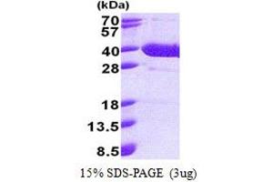 SDS-PAGE (SDS) image for Nuclear Factor of kappa Light Polypeptide Gene Enhancer in B-Cells Inhibitor, delta (NFKBID) (AA 1-313) protein (His tag) (ABIN5853211)