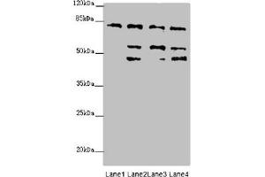 Western blot All lanes: ZFYVE1 antibody at 6. (ZFYVE1 antibody  (AA 1-280))