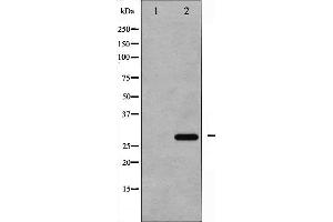 Western blot analysis of p27 Kip1 phosphorylation expression in EGF treated HeLa whole cell lysates,The lane on the left is treated with the antigen-specific peptide. (CDKN1B antibody  (pThr187))