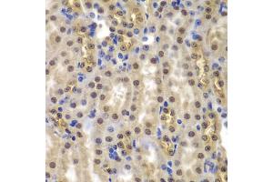 Immunohistochemistry of paraffin-embedded mouse kidney using SMARCB1 antibody (ABIN5973389) at dilution of 1/200 (40x lens). (SMARCB1 antibody)
