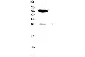 Western blot analysis of CTLA4 using anti-CTLA4 antibody .