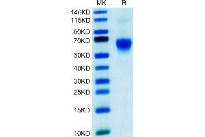 Human Galectin 9 on Tris-Bis PAGE under reduced condition. (Galectin 9 Protein (AA 2-323) (His tag))