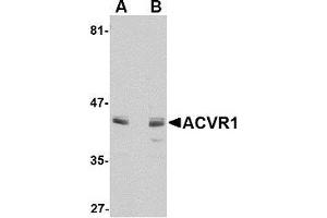 Western blot analysis of ACVR1 in A549 cell lysate with AP30014PU-N ACVR1 antibody at 1 μg/ml in (A) the absence and (B) the presence of blocking peptide. (ACVR1 antibody  (N-Term))