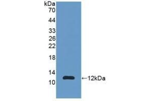 Detection of Recombinant S100A11, Human using Polyclonal Antibody to S100 Calcium Binding Protein A11 (S100A11) (S100A11 antibody  (AA 1-105))