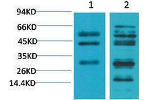 Western Blotting (WB) image for anti-Transforming Growth Factor, beta 1 (TGFB1) antibody (ABIN3181578)