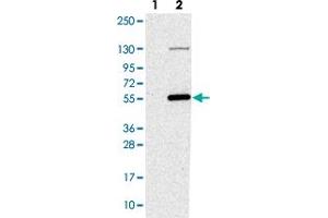 Western blot analysis of Lane 1: Negative control (vector only transfected HEK293T lysate). (NAT16 antibody)