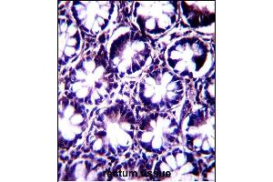 KI Antibody (C-term) (ABIN657603 and ABIN2846601) immunohistochemistry analysis in formalin fixed and paraffin embedded human rectum tissue followed by peroxidase conjugation of the secondary antibody and DAB staining. (KIAA1274 antibody  (C-Term))