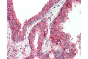 Immunohistochemistry (IHC) image for anti-ADAM Metallopeptidase with Thrombospondin Type 1 Motif, 4 (ADAMTS4) (AA 101-150) antibody (ABIN6755423)