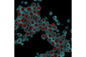 Immunofluorescence Analysis of RAW cells labeling KRT6 with KRT6 Mouse Monoclonal Antibody (SPM269) followed by Goat anti-Mouse IgG-CF488 (Cyan). (KRT6A/KRT6B/KRT6C (C-Term) antibody)