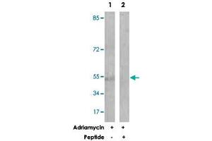 Western blot analysis of extracts from HUVEC cells, treated with Adriamycin (0. (Caspase 2 antibody  (Ser140))
