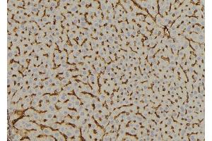 ABIN6269059 at 1/100 staining Mouse liver tissue by IHC-P. (DOK2 antibody  (Internal Region))