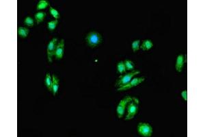 Immunofluorescent analysis of HepG2 cells using ABIN7165334 at dilution of 1:100 and Alexa Fluor 488-congugated AffiniPure Goat Anti-Rabbit IgG(H+L) (EVI2A antibody  (AA 31-133))