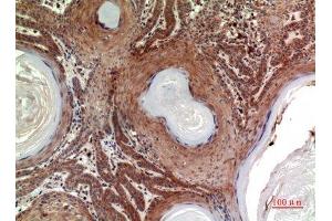 Immunohistochemistry (IHC) analysis of paraffin-embedded Human Skin, antibody was diluted at 1:100.