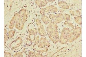 Immunohistochemistry of paraffin-embedded human pancreatic tissue using ABIN7149799 at dilution of 1:100 (DET1 antibody  (AA 15-240))
