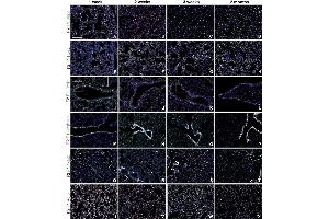 Immunostaining (ISt) image for anti-Perilipin 2 (PLIN2) (AA 1-29), (N-Term) antibody (ABIN285650)
