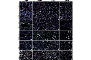 Fgfr1 and Fgfr2 expression during postnatal lung development. (ADRP antibody  (N-Term))