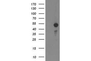 Western Blotting (WB) image for anti-Myocyte Enhancer Factor 2C (MEF2C) antibody (ABIN1499362) (MEF2C antibody)