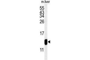 Western blot analysis of TMIE Antibody (Center) in mouse liver tissue lysates (35 µg/lane). (TMIE antibody  (Middle Region))