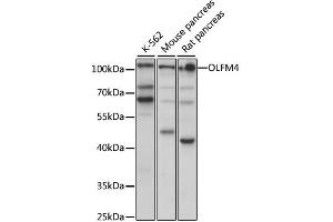Western blot analysis of extracts of various cell lines, using OLFM4 antibody (ABIN6290716) at 1:1000 dilution. (Olfactomedin 4 antibody)