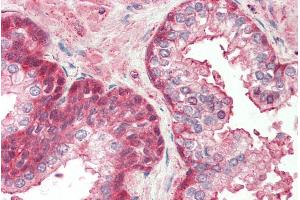 ABIN570703 (5µg/ml) staining of paraffin embedded Human Prostate. (RCBTB2 antibody  (Internal Region))
