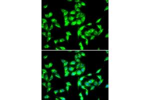 Immunofluorescence analysis of HeLa cell using ANTXR1 antibody.
