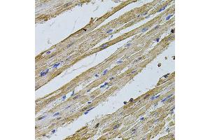 Immunohistochemistry of paraffin-embedded rat heart using CSNK2B antibody (ABIN1872042) at dilution of 1:100 (40x lens).