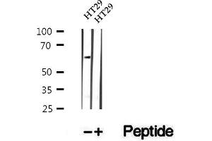 Western blot analysis of extracts of HT29 cells, using Phospho-CDC25B(Ser151) Antibody.
