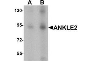 Western blot analysis of ANKLE2 in SW480 cell lysate with ANKLE2 antibody at (A) 1 and (B) 2 ug/mL. (ANKLE2 antibody  (Middle Region))