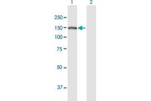 SKIV2L antibody  (AA 1-1246)