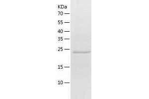 Western Blotting (WB) image for Kallikrein 14 (KLK14) (AA 24-250) protein (His tag) (ABIN7287836) (Kallikrein 14 Protein (KLK14) (AA 24-250) (His tag))