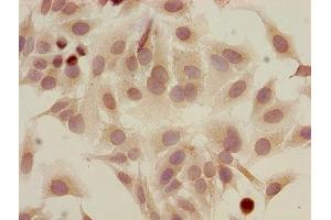 Immunocytochemistry analysis of Hela cells using ABIN7139183 at dilution of 1:100