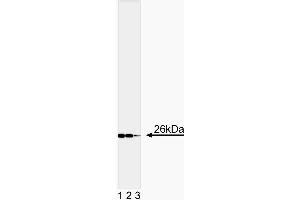 Western blot analysis of Bcl-2 (Second Panel). (Bcl-2 antibody  (AA 41-54))