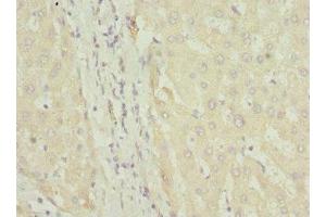 Immunohistochemistry of paraffin-embedded human liver tissue using ABIN7152580 at dilution of 1:100 (FASTK antibody  (AA 360-549))