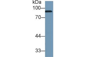 Western Blot; Sample: Human Serum; Primary Ab: 1µg/ml Rabbit Anti-Human CFB Antibody Second Ab: 0. (Complement Factor B antibody  (AA 477-600))