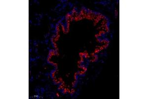 Immunofluorescence analysis of paraffin embedded mouse lung using Flt4 (ABIN7076194) at dilution of 1: 400 (Vegf Receptor 3 antibody)