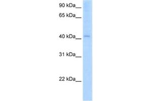 Western Blotting (WB) image for anti-Arylacetamide Deacetylase (Esterase) (AADAC) antibody (ABIN2462826)