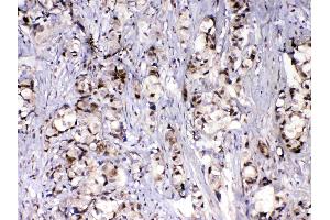 Immunohistochemistry (IHC) image for anti-Mediator Complex Subunit 9 (MED9) (AA 55-146) antibody (ABIN5519032)